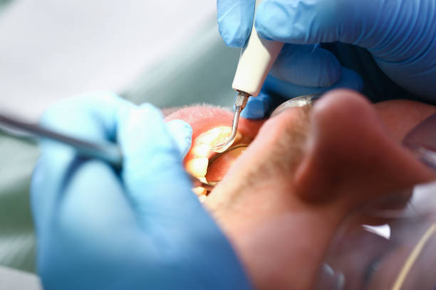 Best Emergency Dental Surgery in Roselle, IL