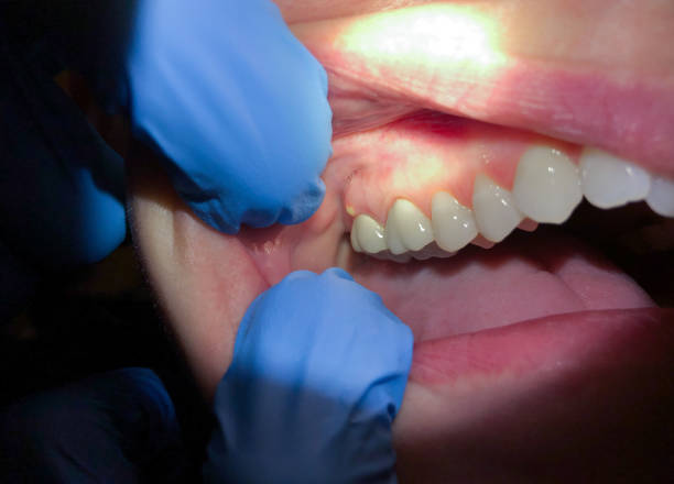 Best Emergency Treatment for Toothache in Roselle, IL